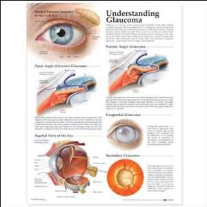  Understanding Glaucoma Anatomical Chart 20 X 26 