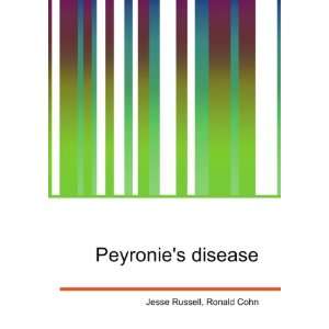  Peyronies disease Ronald Cohn Jesse Russell Books