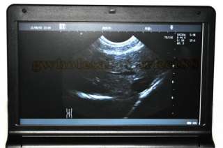   ultrasound scanner ultrasound system convex probe model rus 9000f