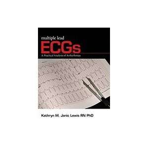   Lead ECGs A Practical Analysis of Arrhythmias (Paperback, 2009) Books