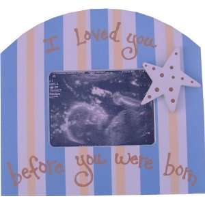  Sonogram Frame in Blue Candy Stripe Baby