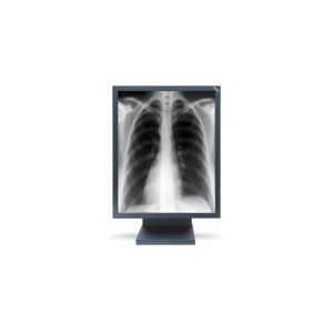  NEC MultiSync 3MP 21 LCD Medical Display (Clear Base 